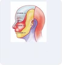 三叉神经痛与普通头疼