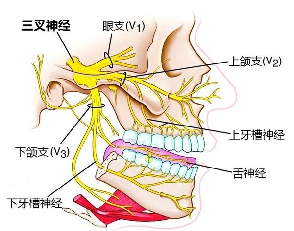 三叉神经痛 (1)