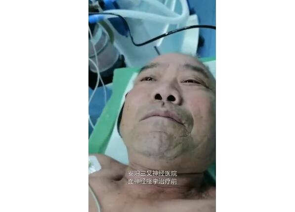 康复案例【视频】